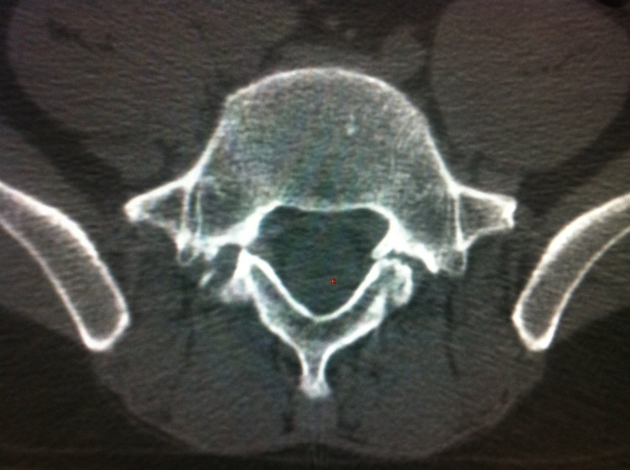 Photo – Interventional Radiology