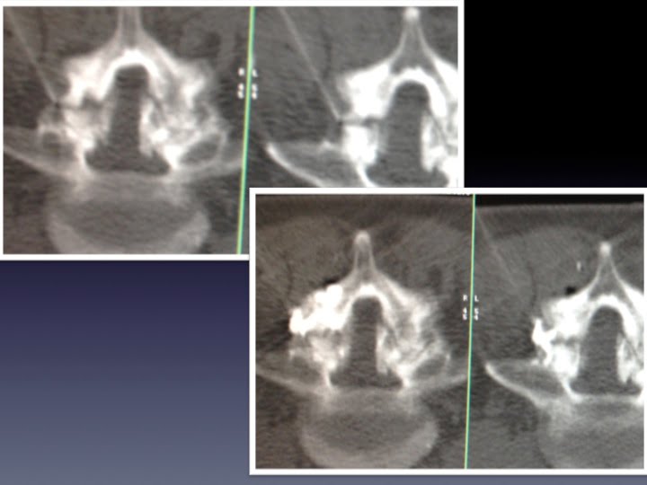 Diapositive07 Interventional Radiology