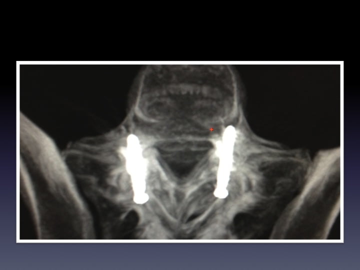 Diapositive33 Interventional Radiology